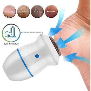 Электрическая пилочка для ног, Портативная USB Перезаряжаемая, для удаления мозолей, омертвевшей кожи, Электрическая Машина для Вакуумного Адсорбционного педикюра